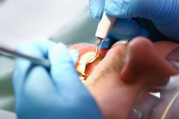 Best Emergency Treatment for Jaw Pain or Injury in Columbia, PA